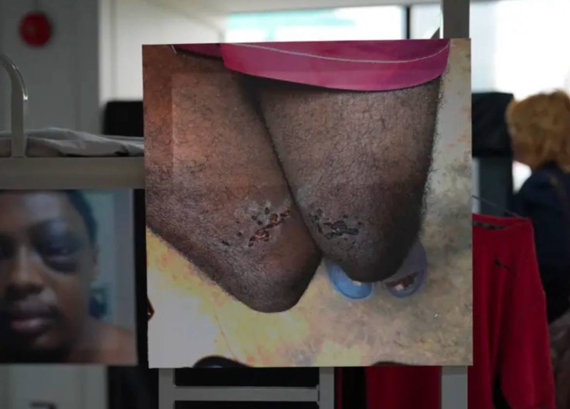 曼谷外国记者协会正在举办一场展览,讲述缅甸妙瓦底诈骗园区受害者遭遇的虐待